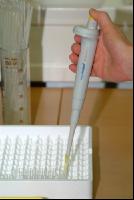 Sperma untersuchen 4