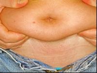 Bauch