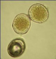 Braunrost Uredosporen 3
