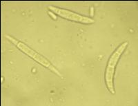 Fusarium Sporen 2