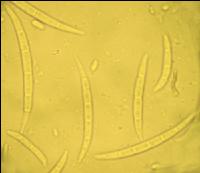 Fusarium Sporen 1