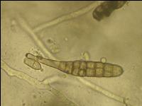 Alternaria Sporen 1
