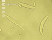 Fusarium Sporen 2