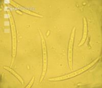 Fusarium Sporen 1