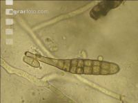 Alternaria Sporen 1