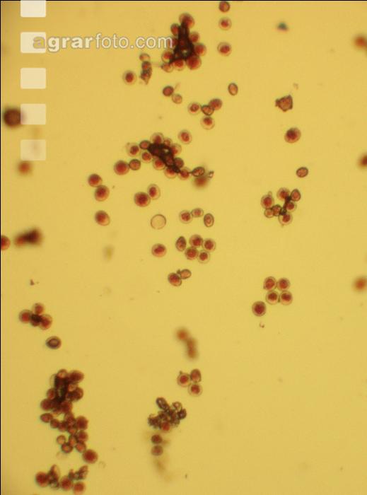 Braunrost Uredosporen 2