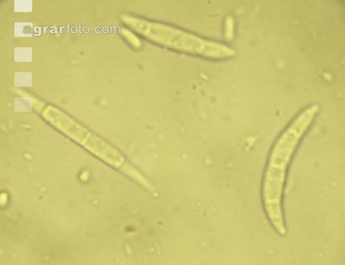 Fusarium Sporen 2