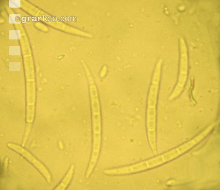 Fusarium Sporen 1
