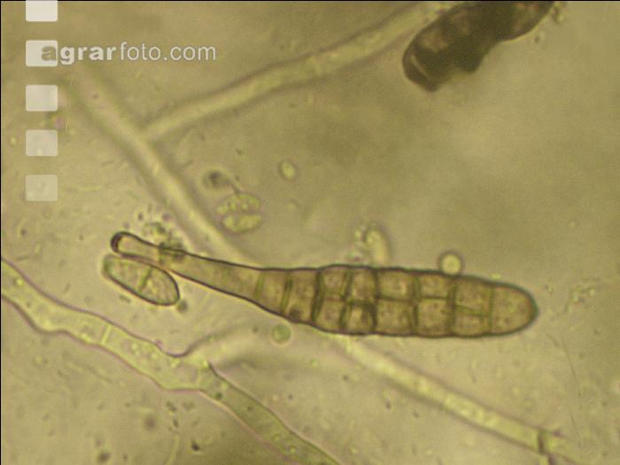 Alternaria Sporen 1
